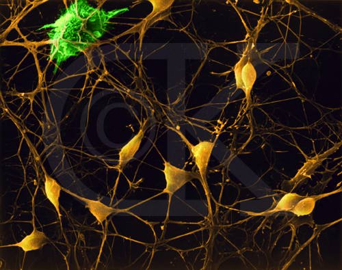 Так выглядят нейроны при 2250-кратном увеличении