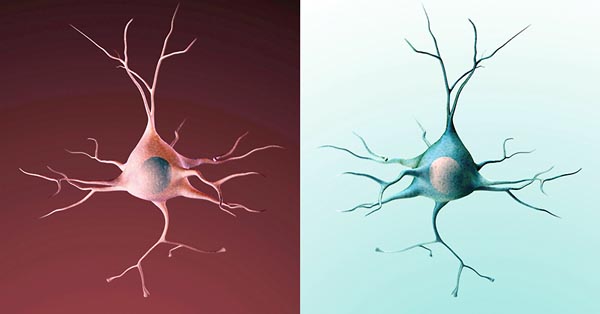Так выглядит зеркальный нейрон здорового человека. Фото: NIH.
