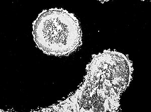 Так выглядит под микроскопом вирус иммунодефицита человека.