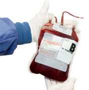 Прежде чем вливать пациенту донорскую кровь, необходимо определить нужную группу и резус-фактор. Тем временем, синтетическая кровь универсальна и подходит любому человеку (фото с сайта viewzone.com).