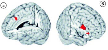 Трехмерная томограмма мозга человека, слушающего музыку. Под ее действием в мозге в разных зонах (а) и (б) зарегистрировано возбуждение.
