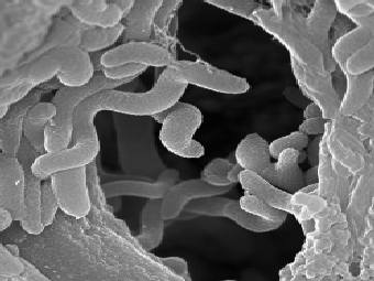 Сульфат-редуцирующие бактерии. Фото с сайта geo.uu.nl.