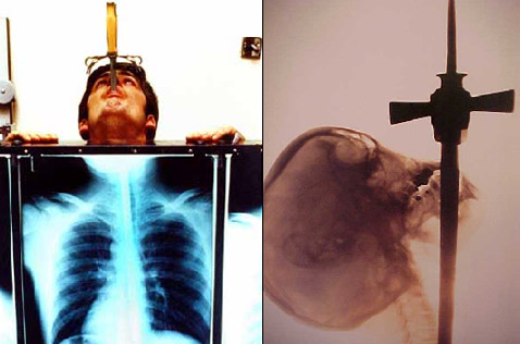Вообще-то, рентгеновские снимки шпагоглоталелей делали и до Уиткомба, но, пожалуй, именно этот рентгенолог провёл наиболее полное изучение глотания лезвий. А на этих снимках вы видите шпагоглотателя Брэда Байерса (Brad Byers) в наши дни и некоего Mighty Ajax, отснятого в 1928 году (фотографии с сайта swordswallow.com).