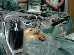 Робот-хирург проводит бескровные операции