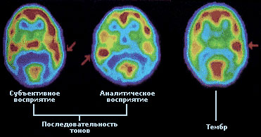 Компьютерная томография позволила сопоставить мышление людей и обезьян