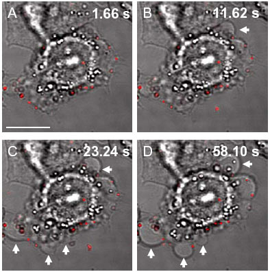 На серии снимков в режиме реального времени стрелками показаны участки, в которых мембрана раковой клетки вздувается пузырями и рвётся. (Размер шкалы – 10 мкм.)