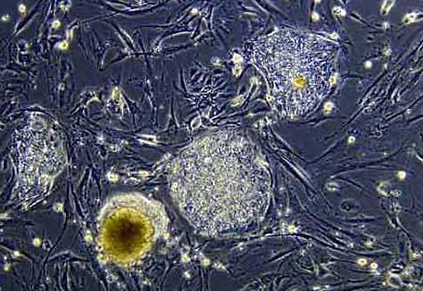 Колония недифференцированных эмбриональных стволовых клеток человека при 10-кратном увеличении