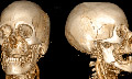 3D сканер человеческого тела