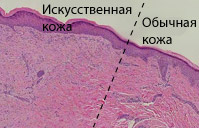 Здесь показан вид под микроскопом повреждённого участка кожного покрова через 28 дней после пересадки: слева — пересажена искусственная кожа, справа — настоящая. Как видите, различие невелико (иллюстрация Intercytex).