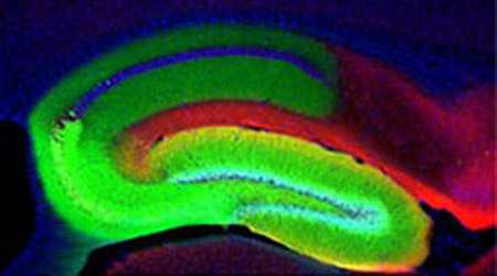 Зелёным показан район гиппокампа мыши, в котором техника DICE-K заблокировала передачу нервных сигналов (фото Toshi Nakashiba, MIT).