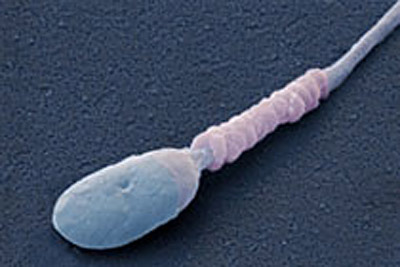 Сперматозоид, иллюстрация с сайта sciencephoto.com